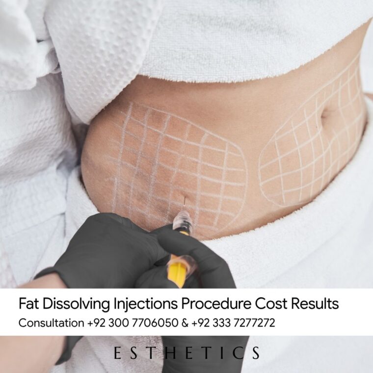 Fat Dissolving Injections Procedure Cost Results