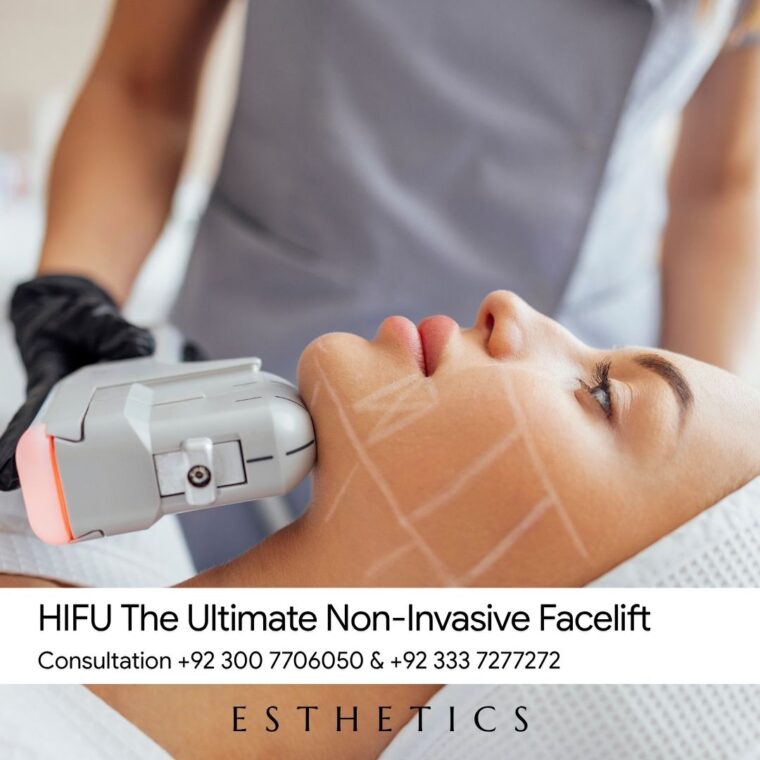 HIFU The Ultimate Non-Invasive Facelift
