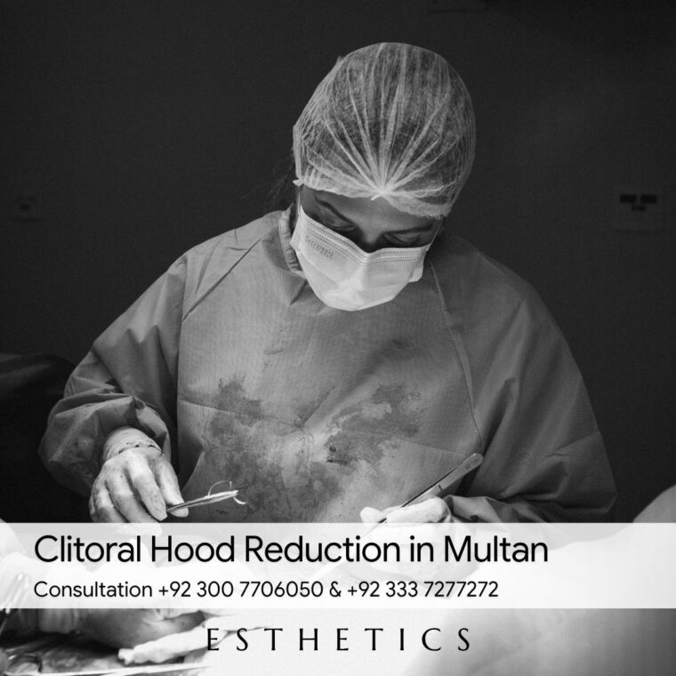 Clitoral Hood Reduction in Multan