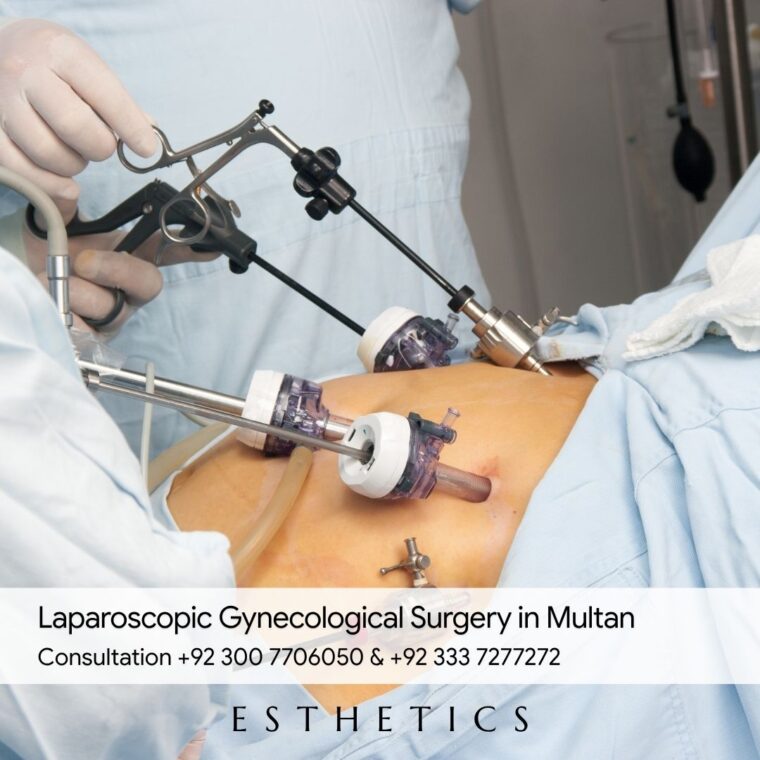 Laparoscopic Gynecological Surgery in Multan
