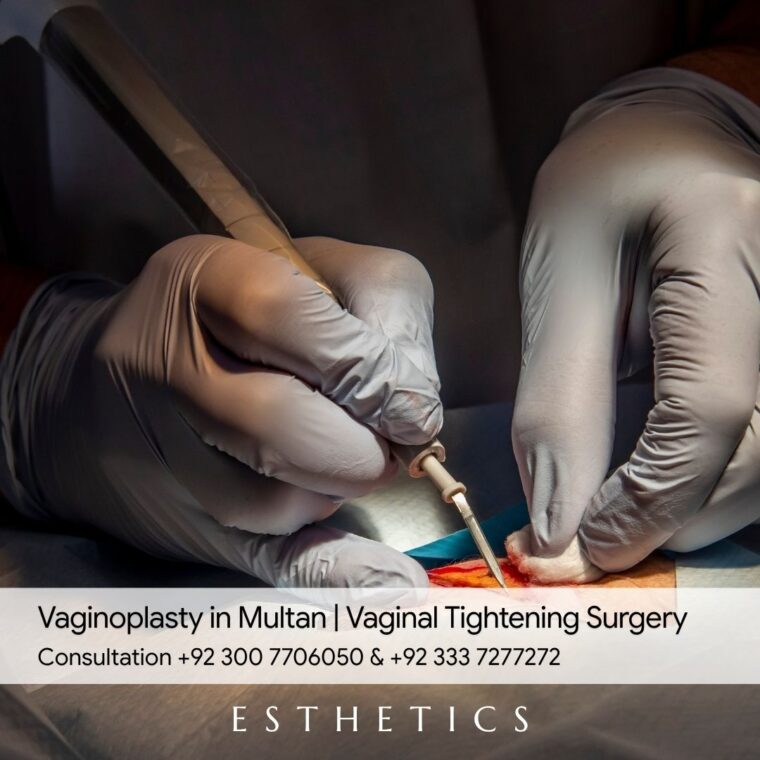 Vaginal Tightening Surgery in multan